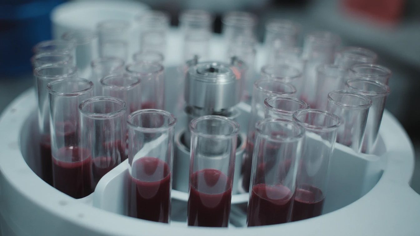 Как проходит процедура PRP